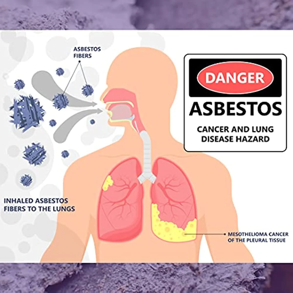 Pro Lab AS108 Asbestos Test Kit – 2 Sample Analysis, Lab Fee & Shipping Included, EPA Approved