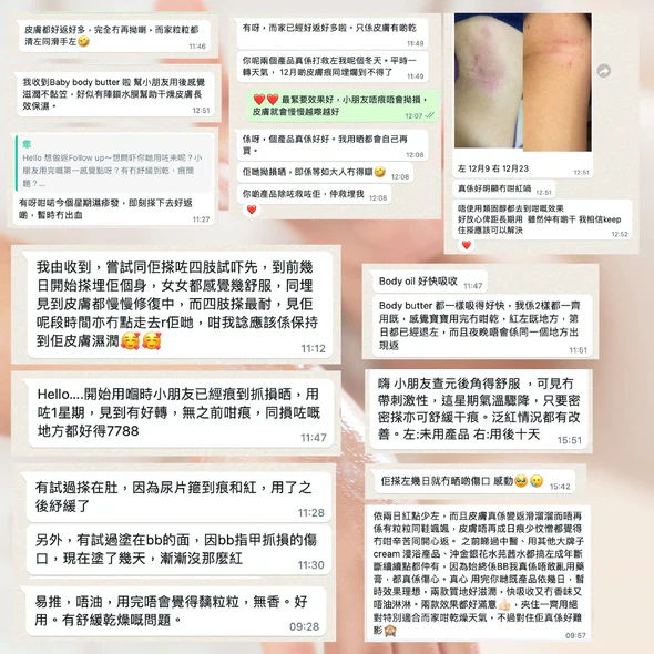 CUBED - 兒童濕疹紓緩護理�?Kids Body Oil 30ml