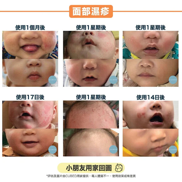 CUBED - 兒童濕疹紓緩護理�?Kids Body Oil 30ml