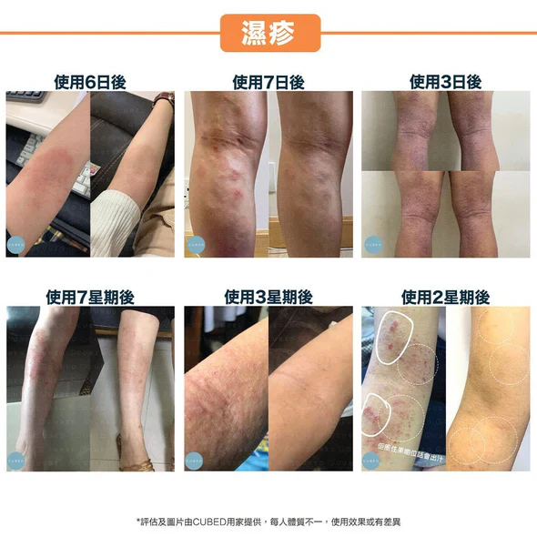 CUBED - 濕疹紓緩護理�?Body Oil 30ml