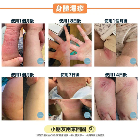 CUBED - 兒童濕疹紓緩護理�?Kids Body Oil 30ml