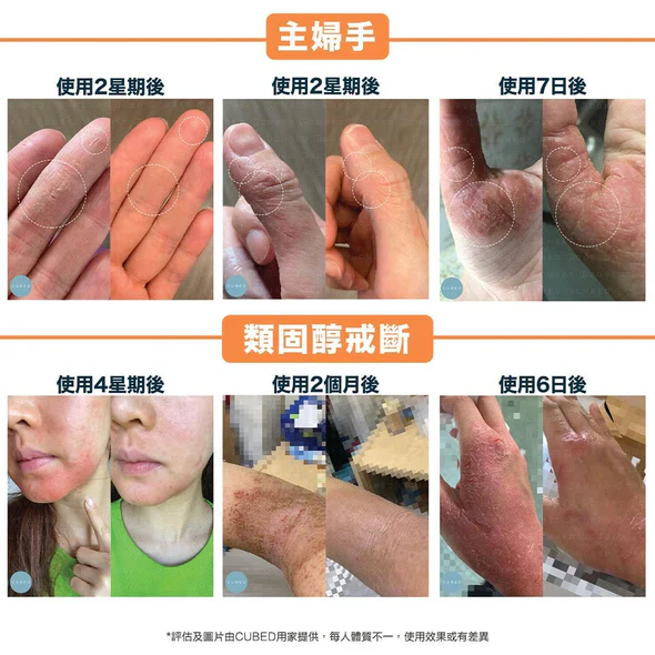 CUBED - 濕疹紓緩護理�?Body Oil 30ml